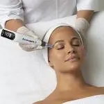 Dermapen image