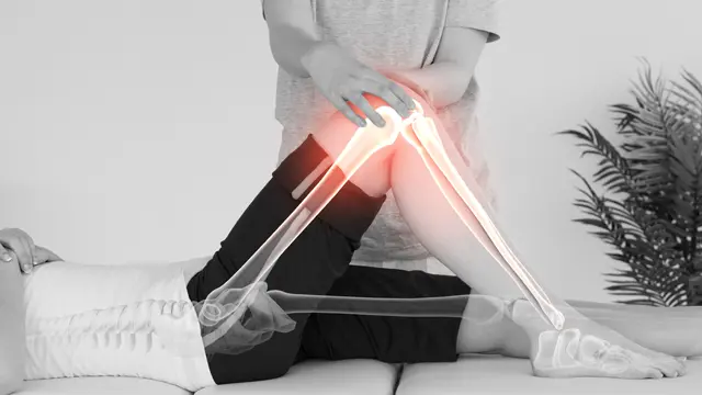 En fysioterapeut behandler en pasient med smerter i kneet, med fokus på leddbevegelser og rehabilitering.