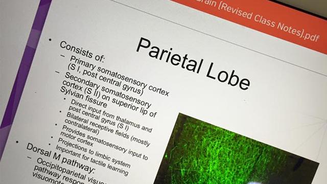 Bilde av notater om parietallappen med punkter om sensorisk korteks og dorsal M-bane.
