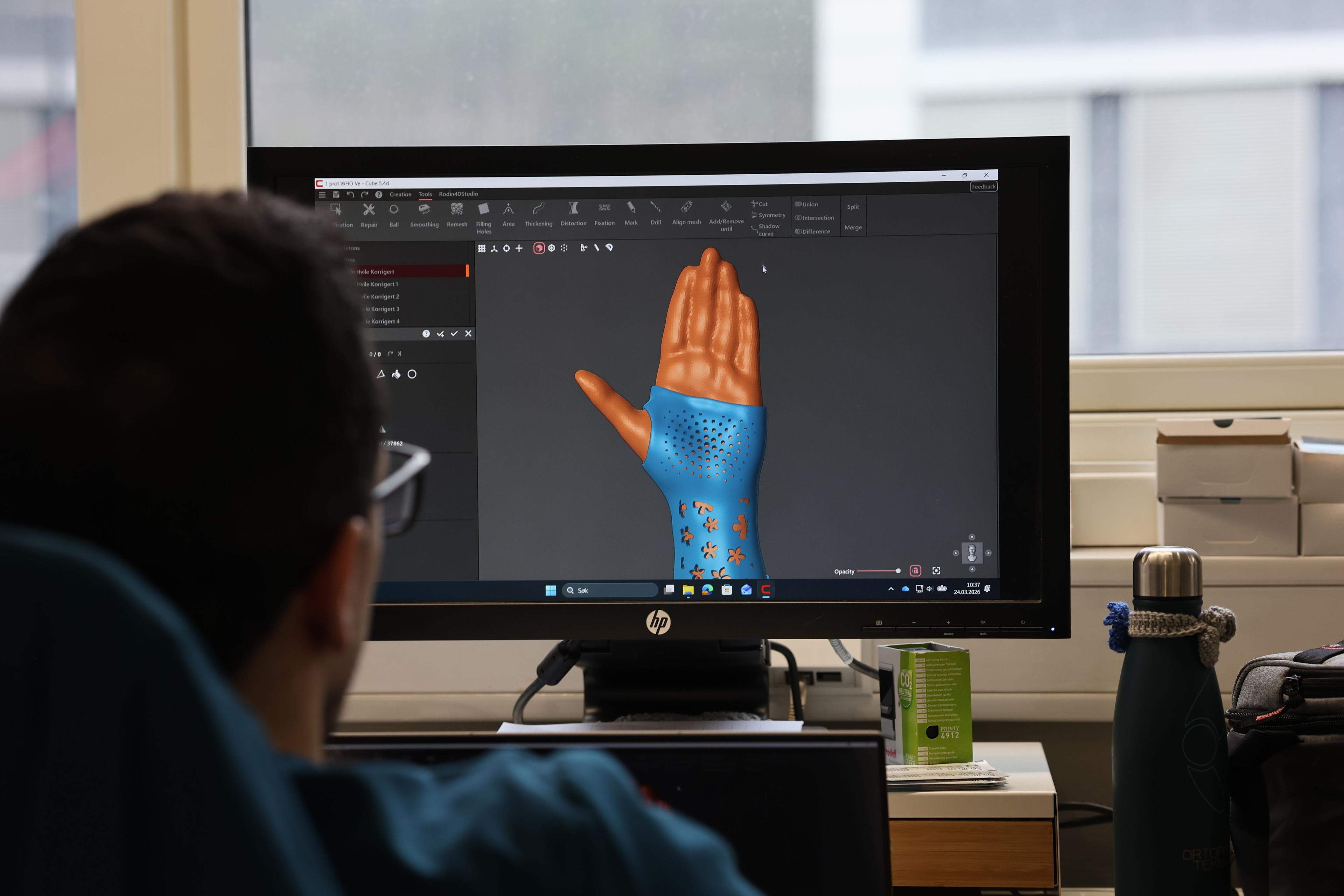 En person ser på en dataskjerm som viser en 3D-modell av en hånd med detaljerte teksturer.