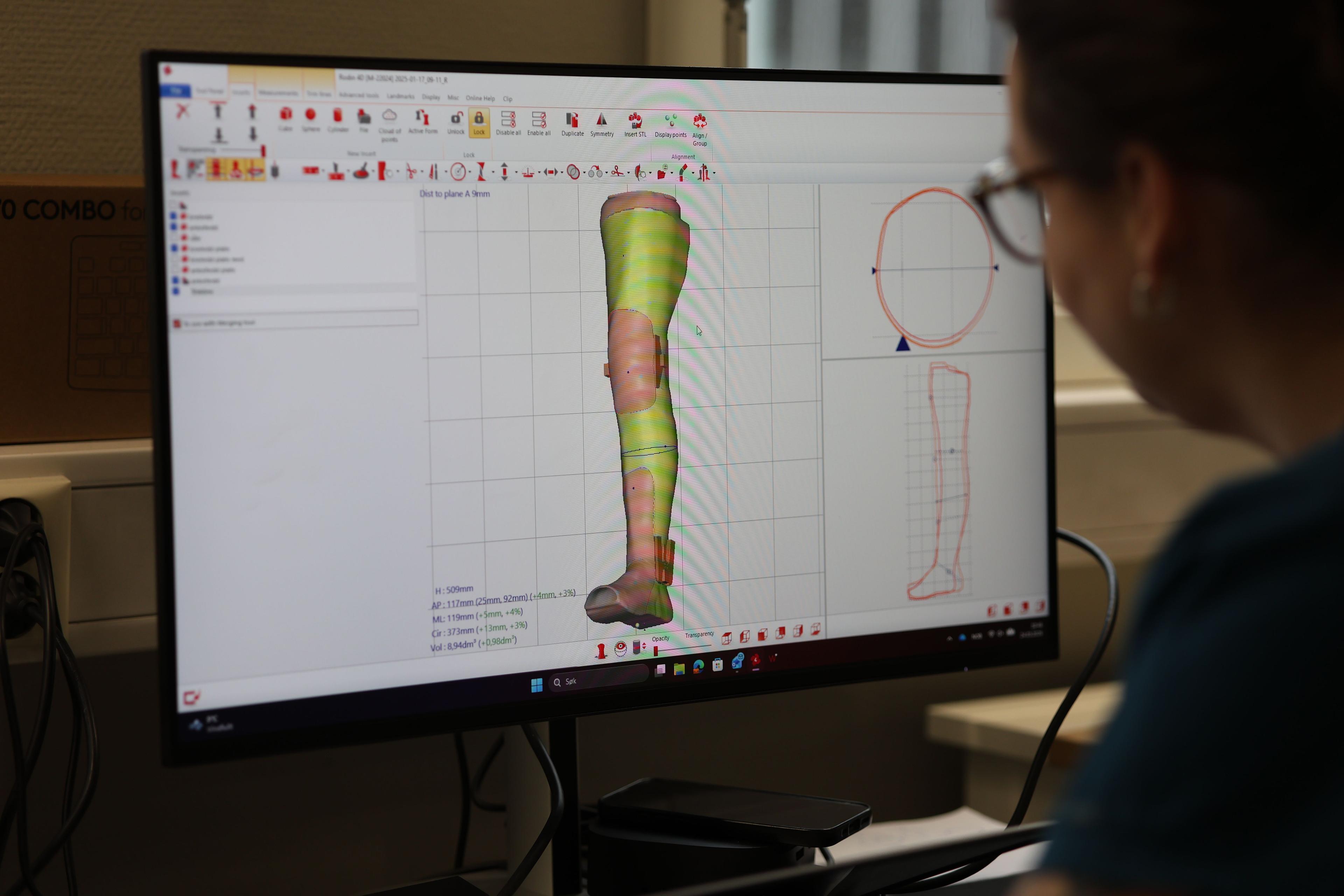 En person ser på en dataskjerm som viser en 3D-modell av et ben med detaljerte målinger.