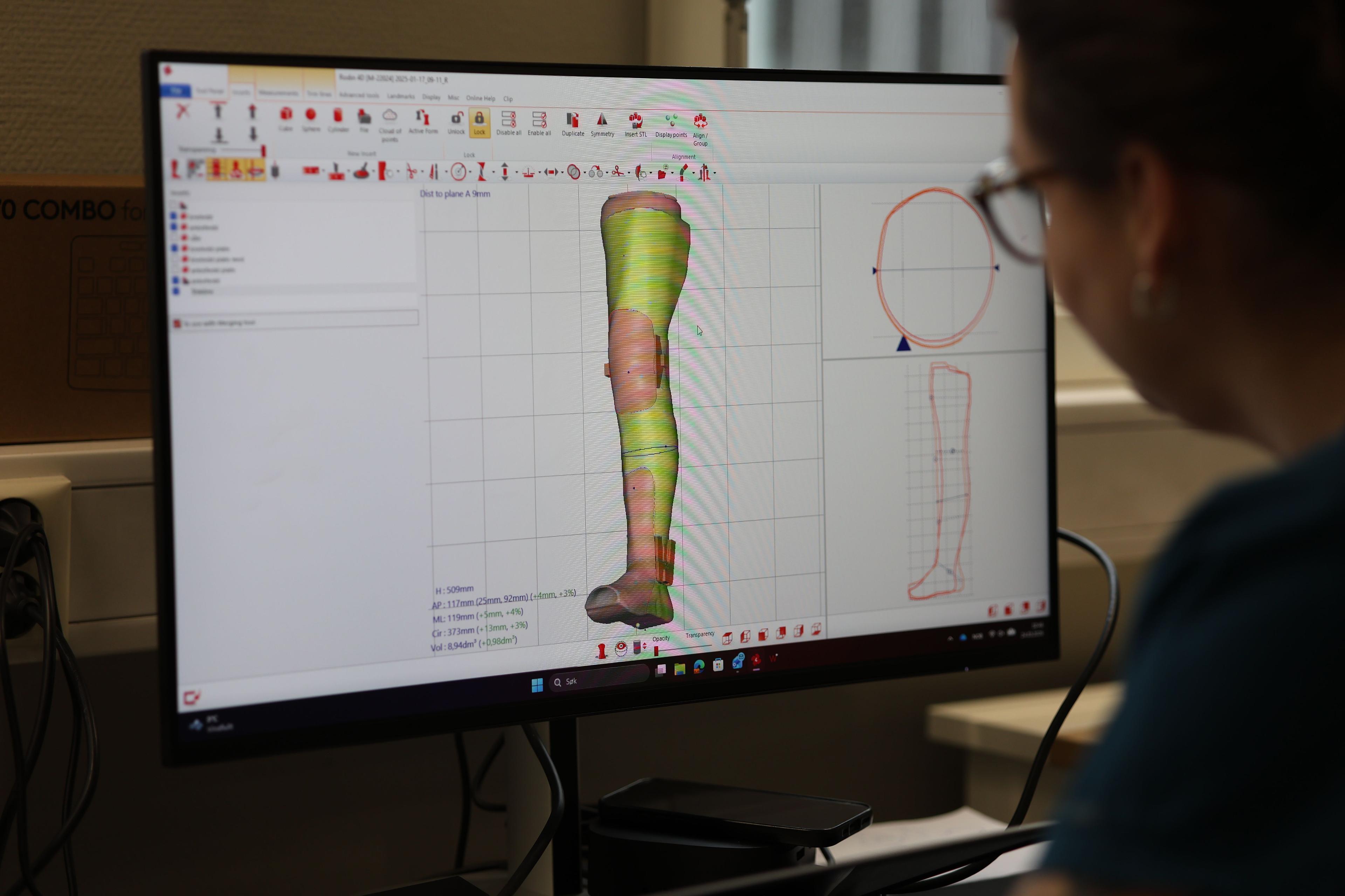 En person ser på en dataskjerm som viser en 3D-modell av et ben med detaljerte målinger.